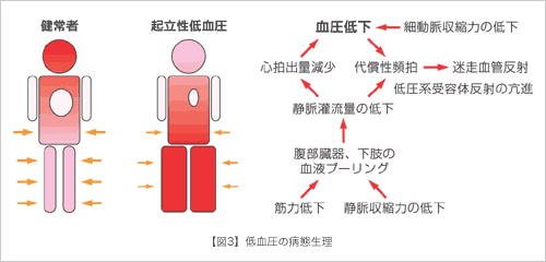 起立性調節障害と整体