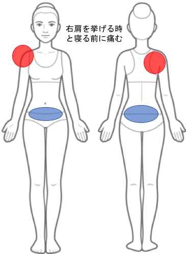 右肩の痛み