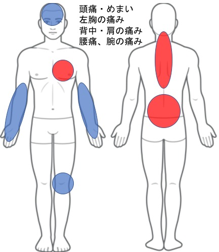 交通事故後の体調不良・全身の痛み