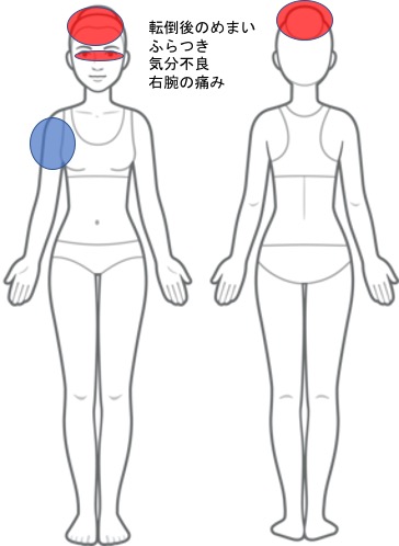 転倒後のめまい・ふらつき・気分不良・右腕の痛み