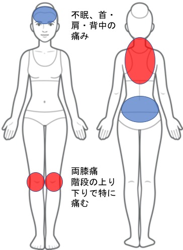 両膝痛、首から背中にかけての痛み、不眠