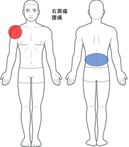 右肩の痛み、腰痛