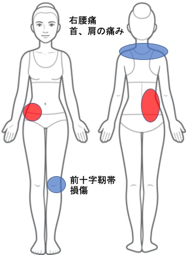 右腰の痛み、首、肩の痛み