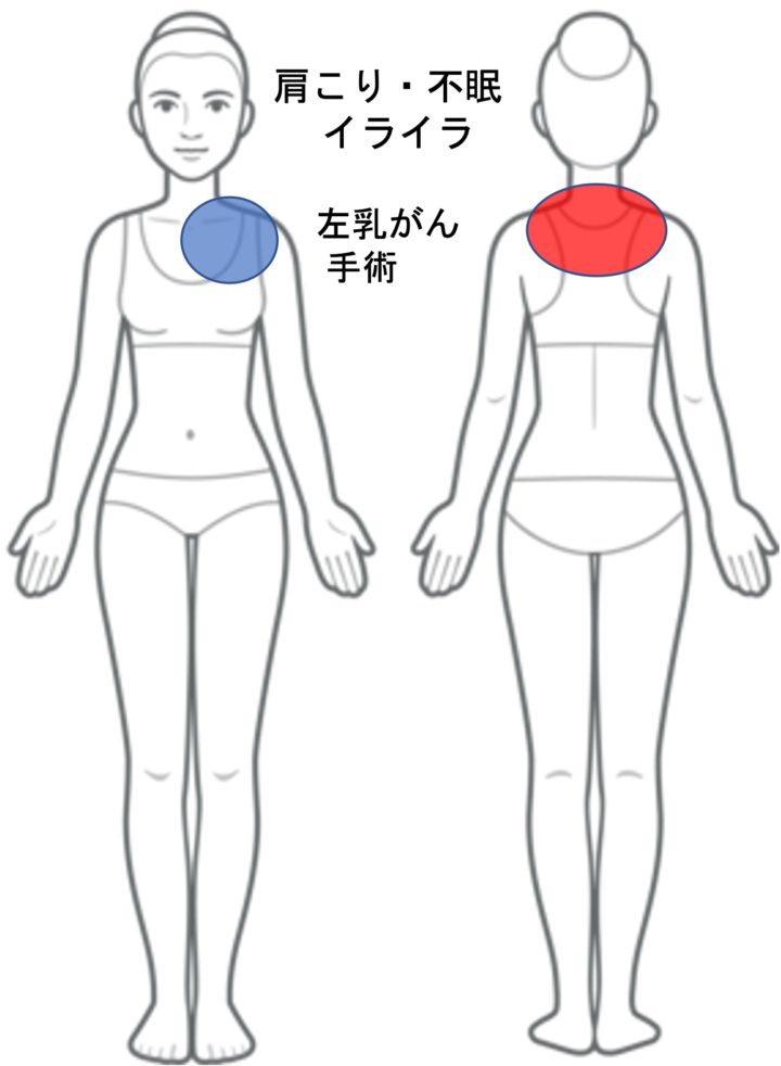 肩こり・不眠・イライラ