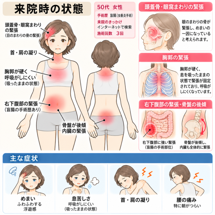 突発性難聴後のめまい・息苦しさ
